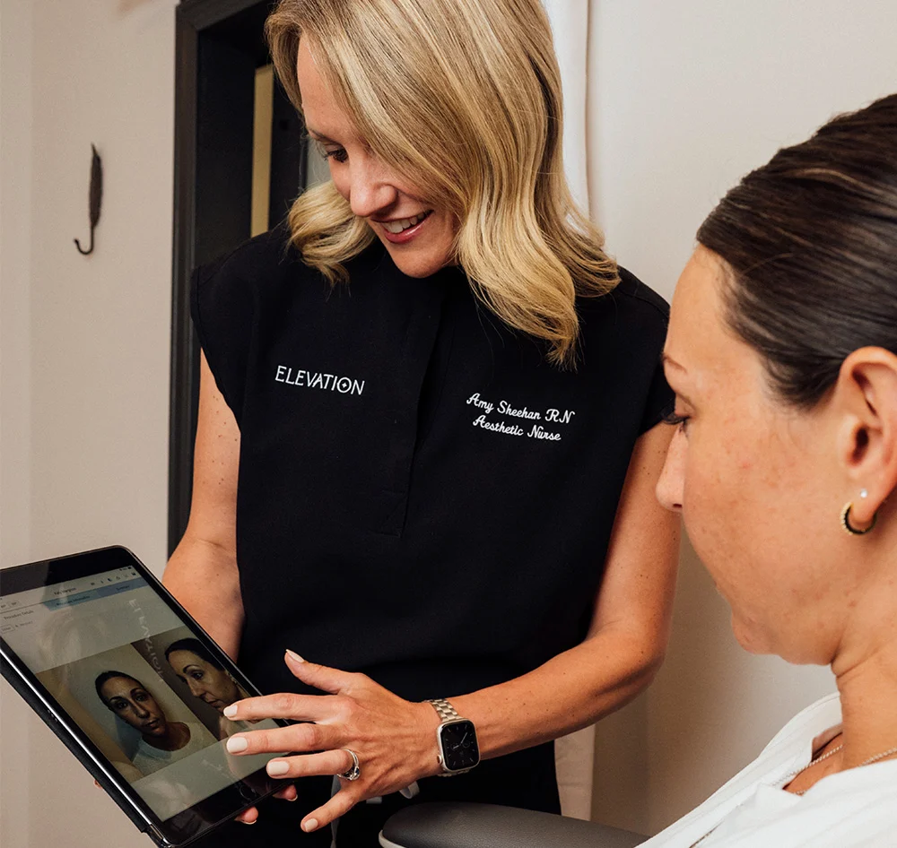 A female aesthetic nurse with blond hair, wearing a black shirt, is standing and holding a tablet to show a client seated in a chair. The tablet shows a split image of a person's face. The client is looking at the tablet as the nurse points to the screen. - IPL in Queensbury, NY