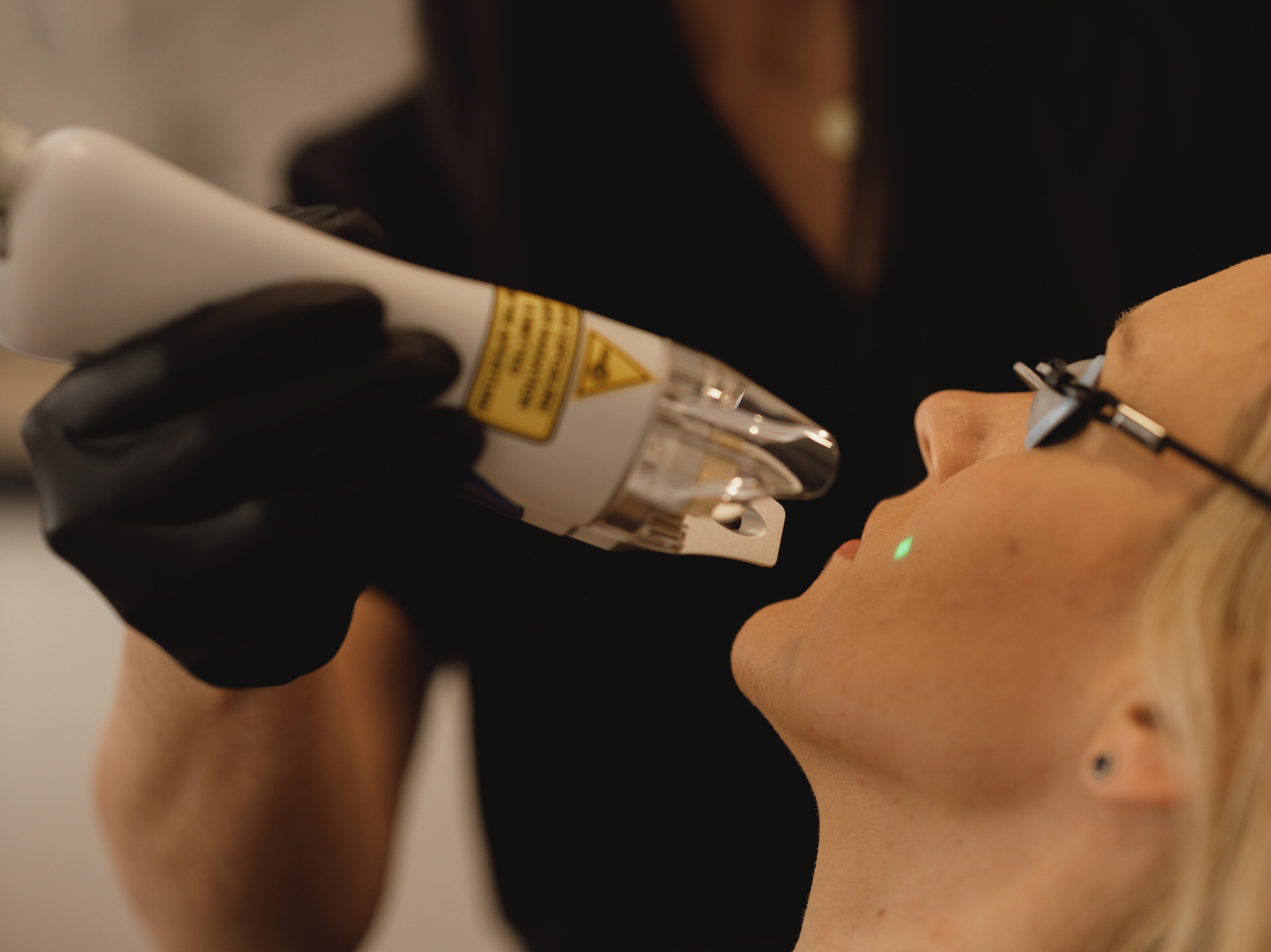 Express Laser Facial 107A9844