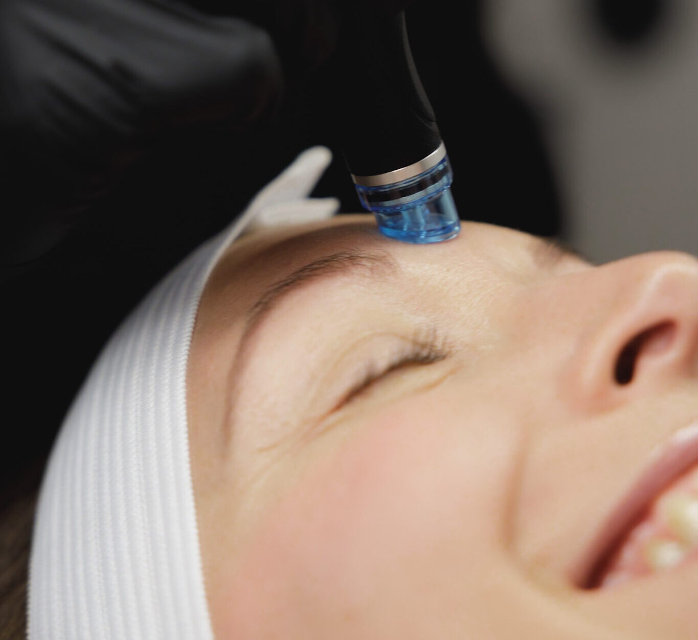 Female smiling while receiving hydrafacial treatment at Elevation Medical Aesthetics