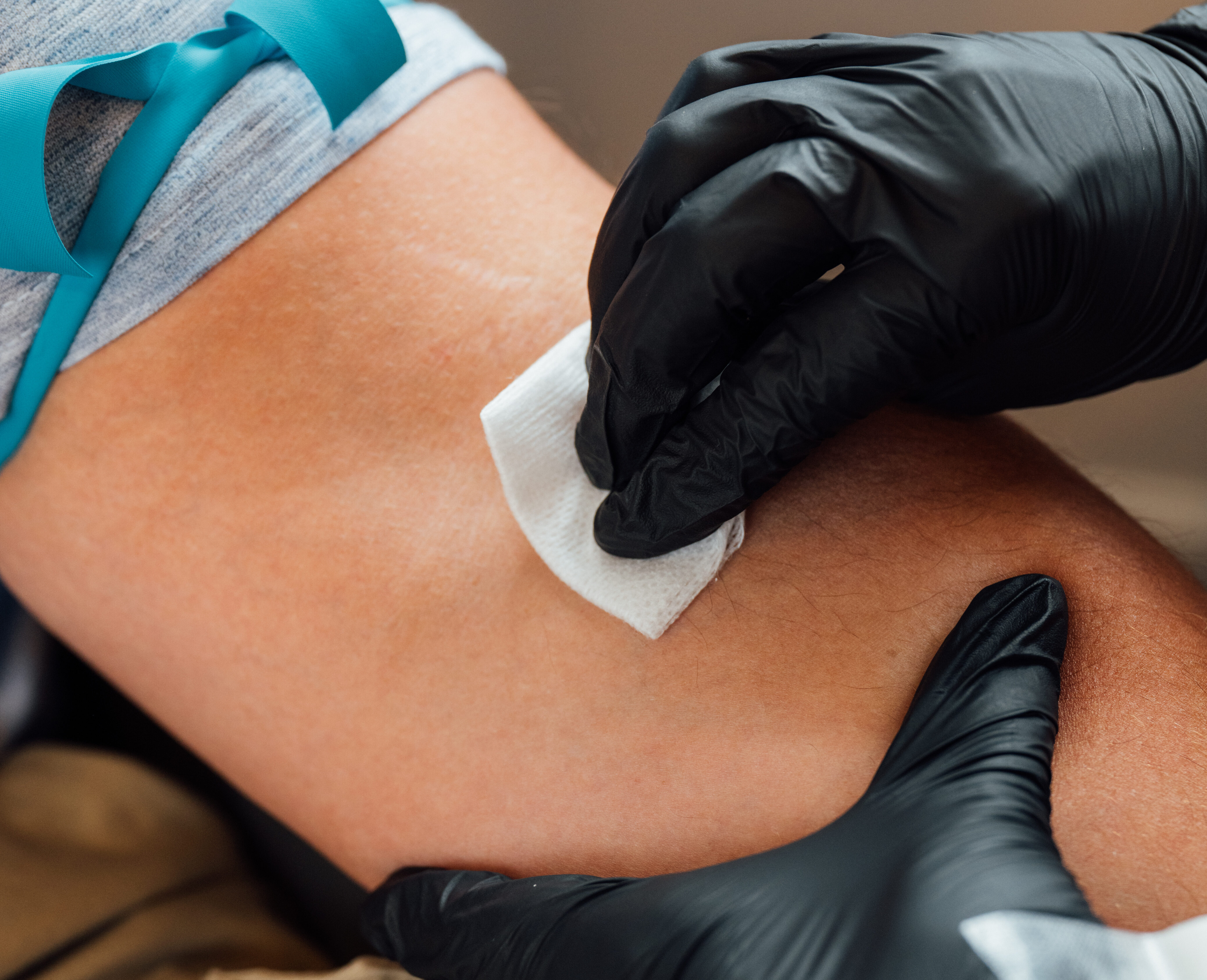 Medically preparing to administer IV hydration therapy to a male patient